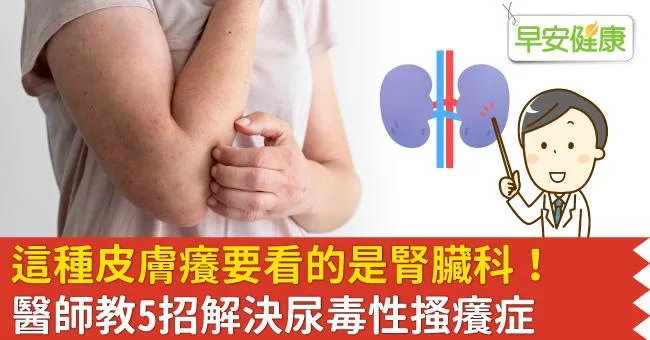 這種皮膚癢要看的是腎臟科！醫師教5招解決尿毒性搔癢症