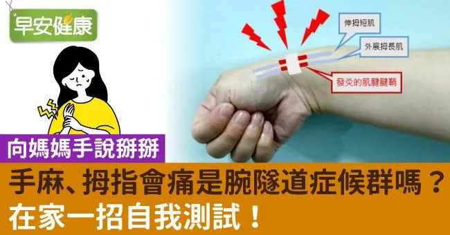 手麻、拇指會痛是腕隧道症候群嗎？在家一招自我測試！