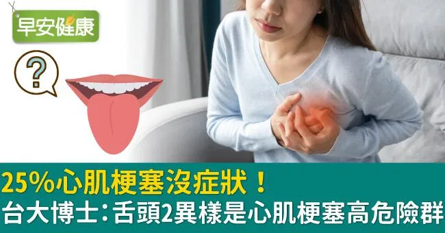 25％心肌梗塞沒症狀！台大博士：舌頭2異樣是心肌梗塞高危險群