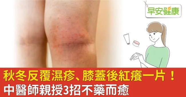 秋冬反覆濕疹、膝蓋後紅癢一片！中醫師親授3招不藥而癒