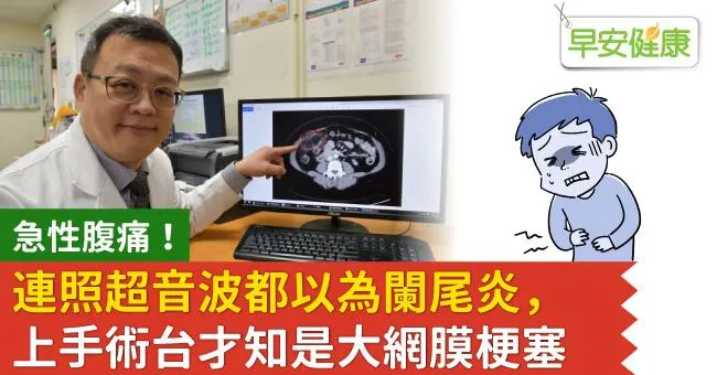 急性腹痛！連照超音波都以為闌尾炎，上手術台才知是大網膜梗塞
