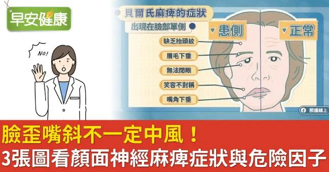 臉歪嘴斜不一定中風！3張圖看顏面神經麻痺症狀與危險因子