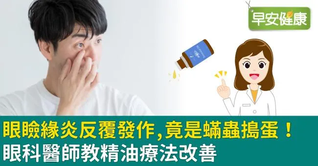 眼瞼緣炎反覆發作，竟是蟎蟲搗蛋！眼科醫師教精油療法改善