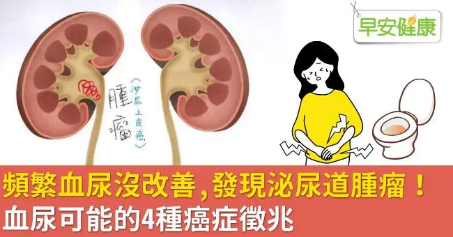 頻繁血尿沒改善，發現泌尿道腫瘤！血尿可能的4種癌症徵兆