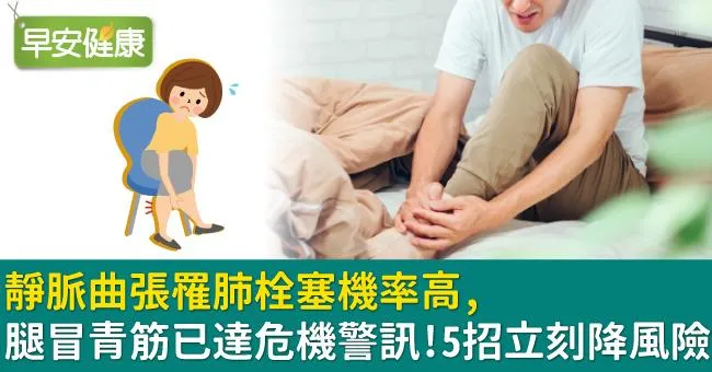 靜脈曲張罹肺栓塞機率高，腿冒青筋已達危機警訊！5招立刻降風險