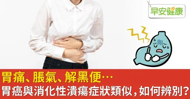 胃痛、脹氣、解黑便…胃癌與消化性潰瘍症狀類似，如何辨別？
