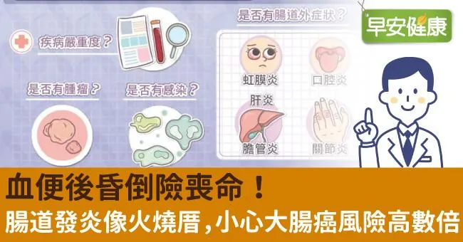 血便後昏倒險喪命！腸道發炎像火燒厝，小心大腸癌風險高數倍