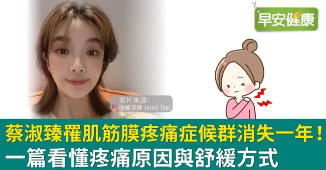 蔡淑臻罹肌筋膜疼痛症候群消失一年！一篇看懂疼痛原因與舒緩方式