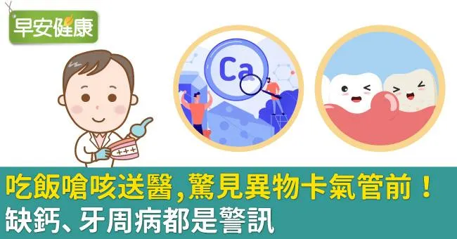 吃飯嗆咳送醫，驚見異物卡氣管前！缺鈣、牙周病都是警訊