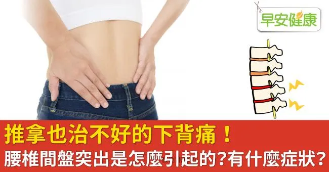 推拿也治不好的下背痛！腰椎間盤突出是怎麼引起的？有什麼症狀？