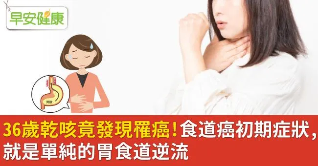 36歲乾咳竟發現罹癌！食道癌初期症狀，就是單純的胃食道逆流