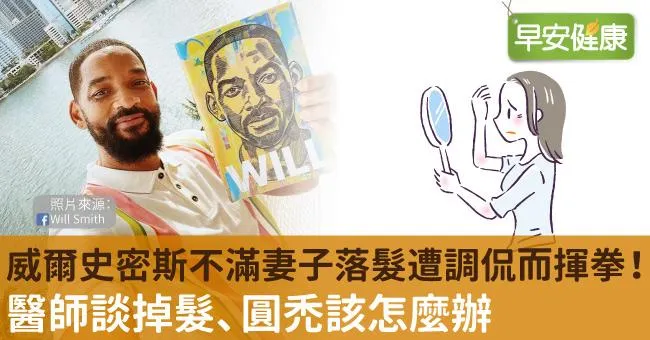 威爾史密斯不滿妻子落髮遭調侃而揮拳！醫師談掉髮、圓禿該怎麼辦