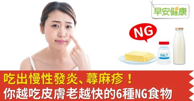 吃出慢性發炎、蕁麻疹！你越吃皮膚老越快的6種NG食物