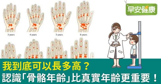 我到底可以長多高？認識「骨骼年齡」比真實年齡更重要！