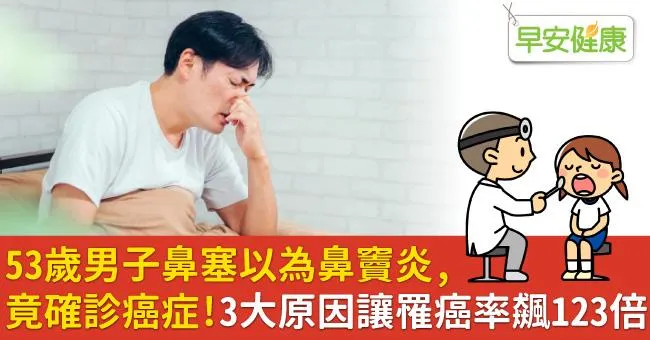 53歲男子鼻塞以為鼻竇炎，竟確診癌症！3大原因讓罹癌率飆123倍