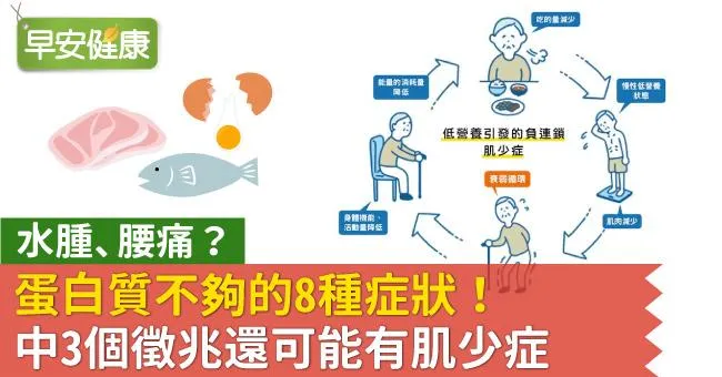 水腫、腰痛？蛋白質不夠的8種症狀！中3個徵兆還可能有肌少症