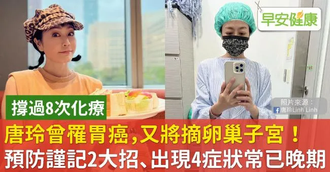 唐玲曾8次化療罹胃癌，又將摘卵巢子宮！預防謹記2大招、出現4症狀常已晚期