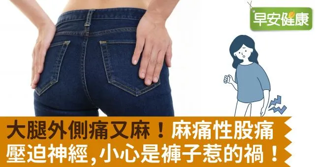 大腿外側痛又麻！麻痛性股痛壓迫神經，小心是褲子惹的禍！
