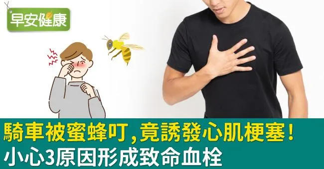38歲男騎車被蜜蜂叮，竟誘發心肌梗塞！小心3原因形成致命血栓