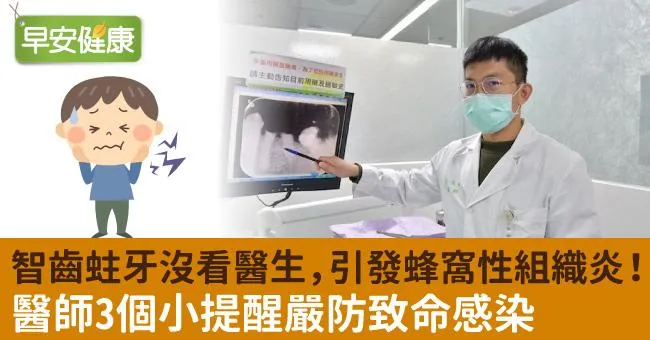 智齒蛀牙沒看醫生，引發蜂窩性組織炎！醫師3個小提醒嚴防致命感染