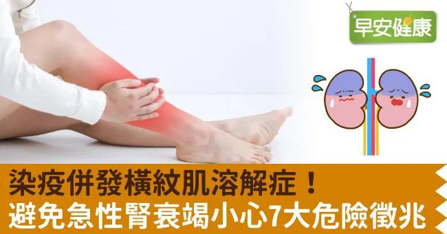 染疫併發橫紋肌溶解症！避免急性腎衰竭小心7大危險徵兆