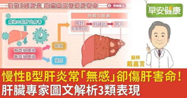 慢性B型肝炎常「無感」卻傷肝害命！肝臟專家圖文解析3類表現