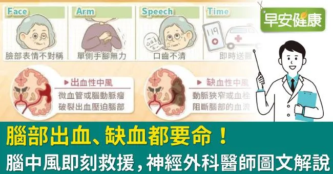 腦部出血、缺血都要命！腦中風即刻救援，神經外科醫師圖文解說