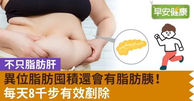 不只脂肪肝，異位脂肪囤積還會有脂肪胰！每天8千步有效剷除