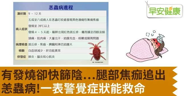 有發燒卻快篩陰⋯腿部焦痂追出恙蟲病！一表警覺症狀能救命