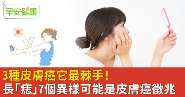 3種皮膚癌它最棘手！長「痣」7個異樣可能是皮膚癌徵兆