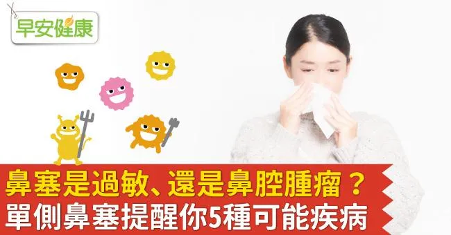 鼻塞是過敏、還是鼻腔腫瘤？單側鼻塞提醒你5種可能疾病
