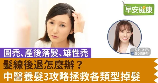 髮線後退怎麼辦？中醫養髮3攻略拯救各類型掉髮