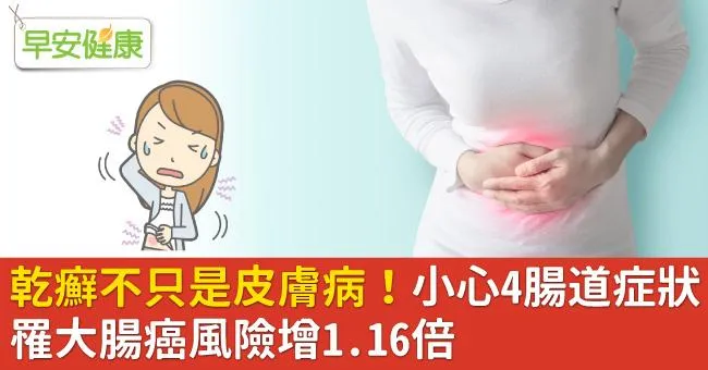 乾癬不只是皮膚病！小心4腸道症狀，罹大腸癌風險增1.16倍