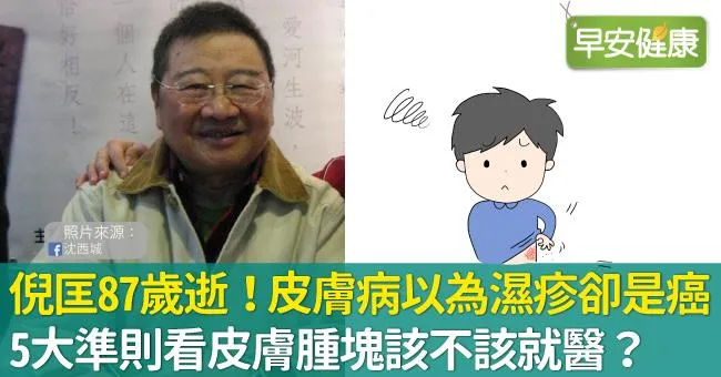 倪匡87歲逝世！皮膚病以為濕疹卻是癌，5大準則看皮膚腫塊該不該就醫？