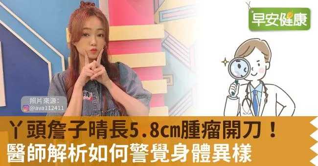 丫頭詹子晴長5.8cm腫瘤開刀！醫師解析如何警覺身體異樣