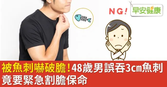 被魚刺嚇破膽！48歲男誤吞3cm魚刺，竟要緊急割膽保命