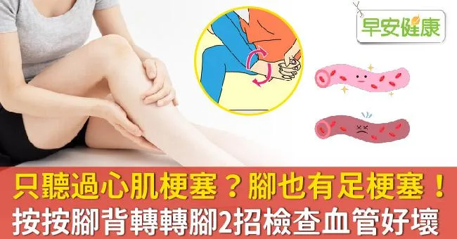 只聽過心肌梗塞？腳也有足梗塞！按按腳背轉轉腳2招檢查血管好壞