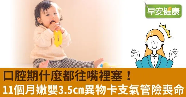 口腔期什麼都往嘴裡塞！11個月嫩嬰3.5cm異物卡支氣管險喪命