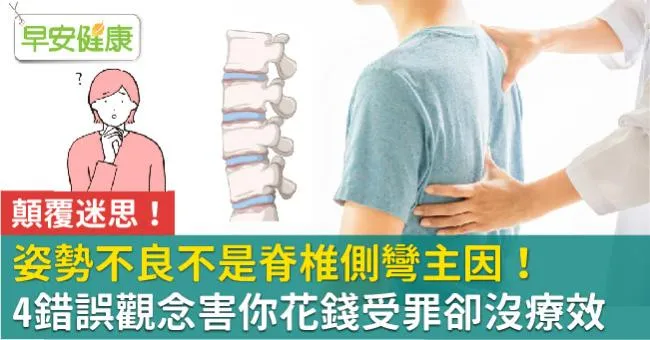 姿勢不良不是脊椎側彎主因！4錯誤觀念害你花錢受罪卻沒療效