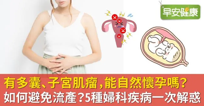 有多囊、子宮肌瘤，能自然懷孕嗎？如何避免流產？5種婦科疾病一次解惑