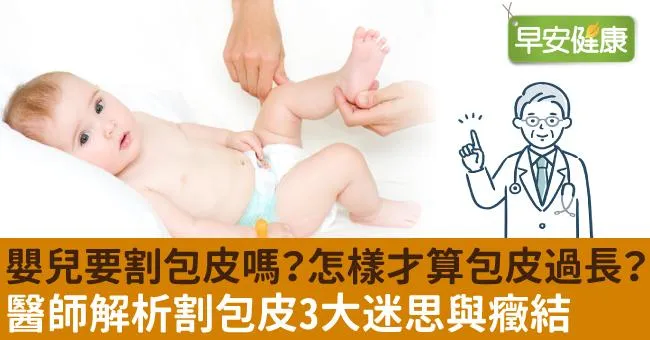 嬰兒要割包皮嗎？怎樣才算包皮過長？醫師解析割包皮3大迷思與癥結