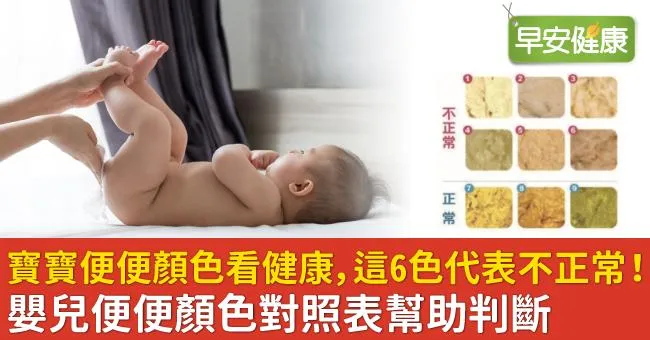寶寶便便顏色看健康，這6色代表不正常！嬰兒便便顏色對照表幫助判斷