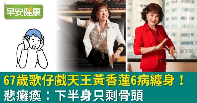 67歲歌仔戲天王黃香蓮6病纏身！悲癱瘓：下半身只剩骨頭