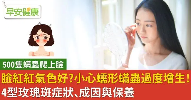 臉紅紅氣色好？小心蠕形蟎蟲過度增生！4型玫瑰斑症狀、成因與保養