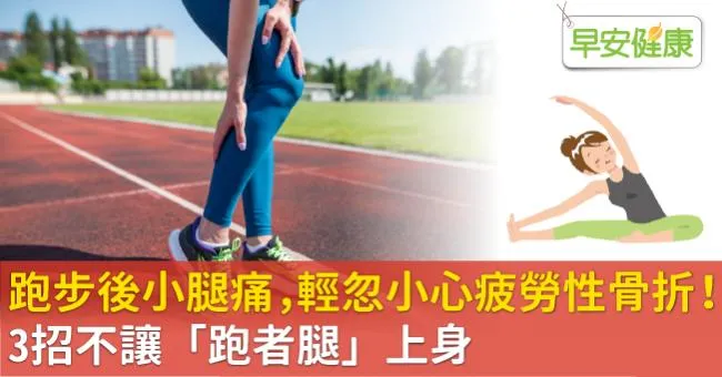 跑步後小腿痛，輕忽小心疲勞性骨折！3招不讓「跑者腿」上身