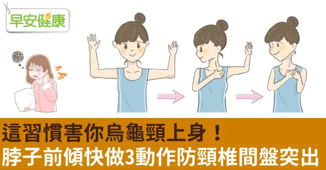 這習慣害你烏龜頸上身！脖子前傾快做3動作防頸椎間盤突出