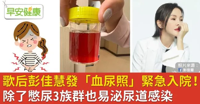 歌后彭佳慧發「血尿照」緊急入院！除了憋尿3族群也易泌尿道感染