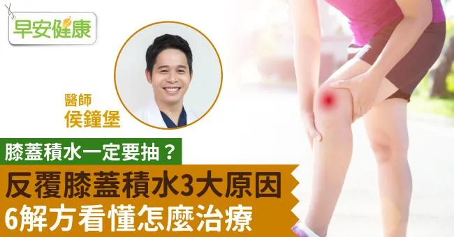 膝蓋積水一定要抽？反覆膝蓋積水3大原因，6解方看懂怎麼治療