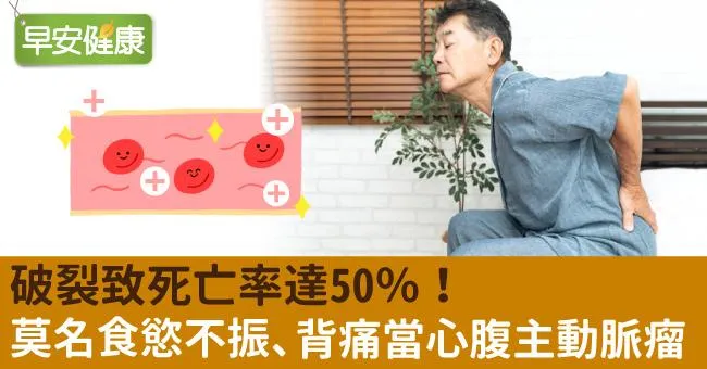 破裂致死亡率達50％！莫名食慾不振、腰背腹痛，當心腹主動脈瘤