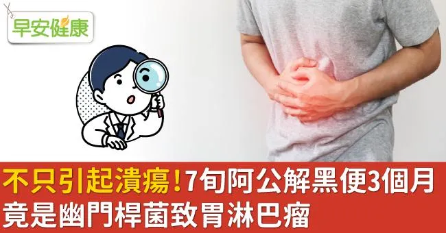 不只引起潰瘍！7旬阿公解黑便3個月，竟是幽門桿菌致胃淋巴瘤